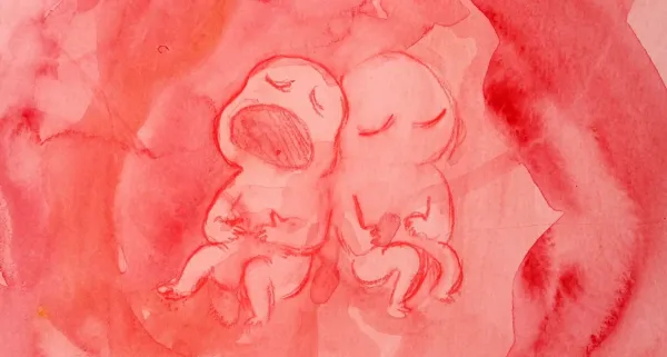 Not Enough Womb for the Two of Us by Cameron Kletke